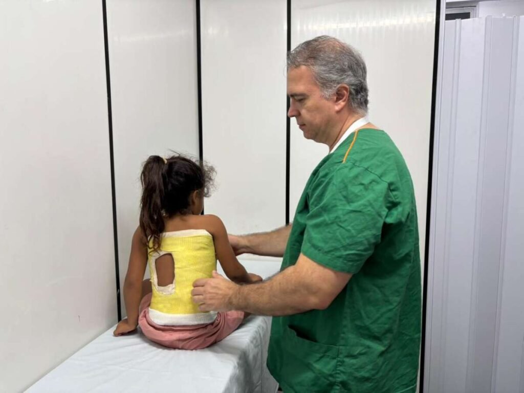 Hospital Infantil Albert Sabin aplica gesso para tratar crianças com escoliose precoce 1 Blog do Eliomar