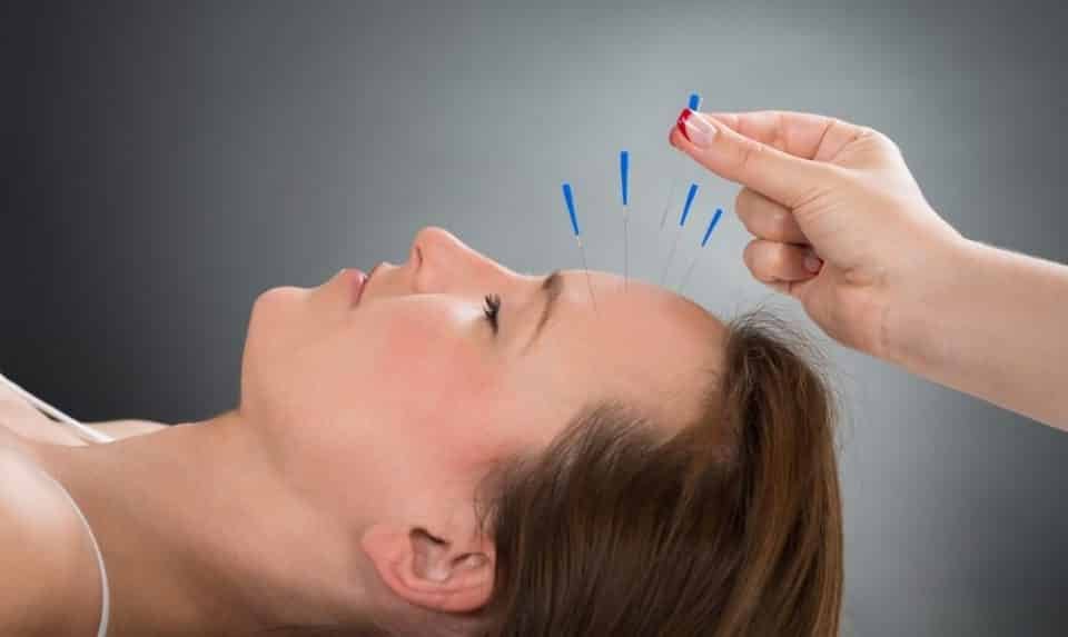 Fortaleza será sede do 16º Congresso Brasileiro de Acupuntura 3 Blog do Eliomar