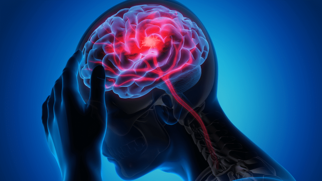 AVC mata uma pessoa a cada seis minutos no Brasil 3 Blog do Eliomar