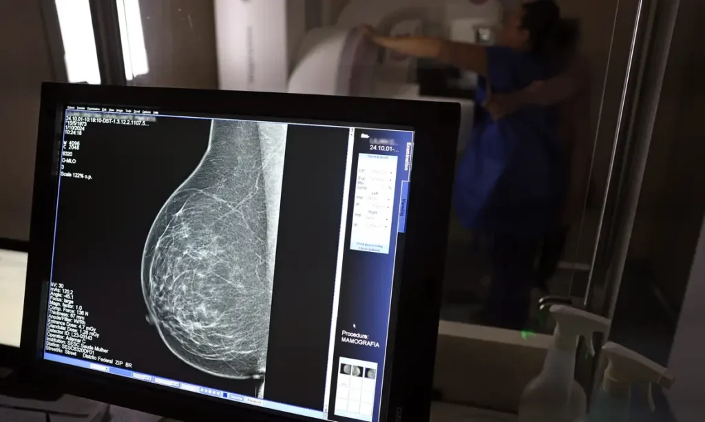 Plano de saúde terá que cobrir mamografia digital para todas as idades, diz ANS 1 Blog do Eliomar